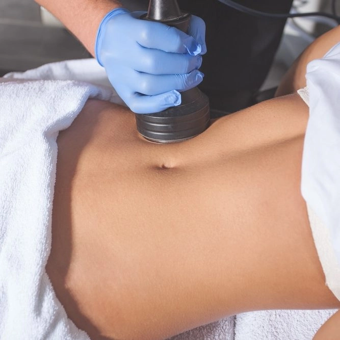 Body contouring treatment on abdomen using advanced skin-tightening device