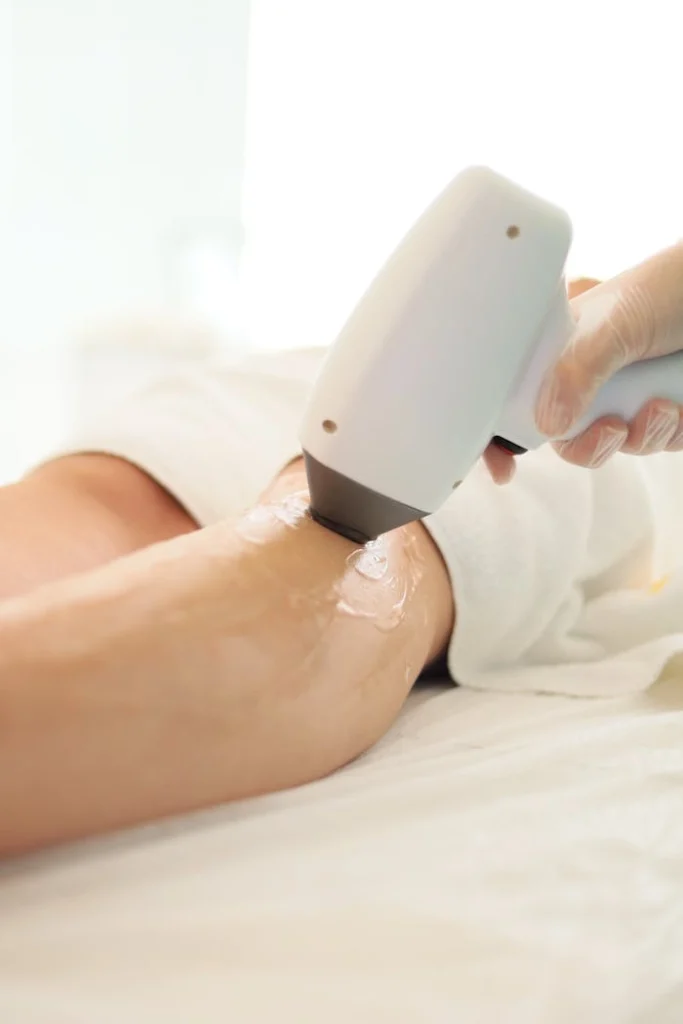 Laser hair removal on leg with cooling gel applied for comfort