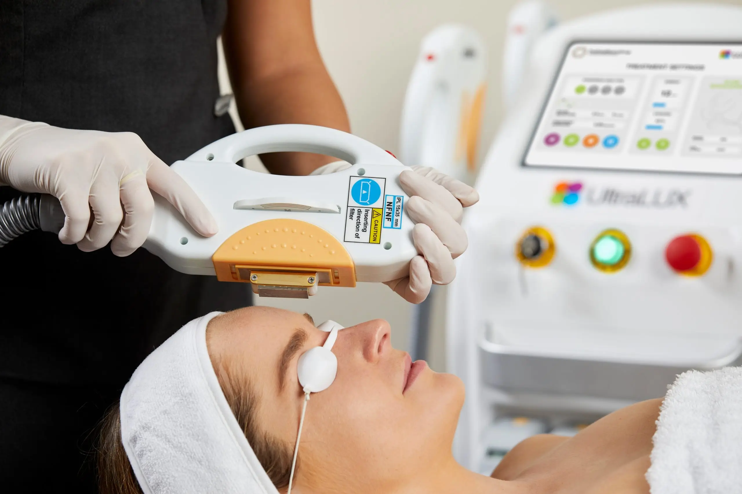 Woman receiving a IPL treatment with protective eye covers.