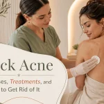 Back Acne – Causes, Treatments, and How to Get Rid of It
