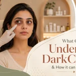 causes dark eye circles