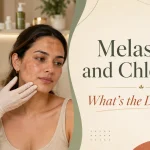 melasma and chloasma