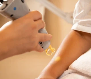 Laser hair removal treatment being performed on a client’s arm