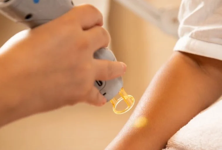 Laser hair removal treatment being performed on a client’s arm