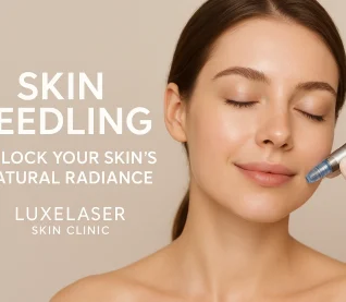Woman receiving skin needling treatment at Luxelaser Skin Clinic for radiant skin.